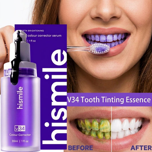 Hismile V34 Purple Whitening Toothpaste – Removes Stains & Yellowing for Brighter Teeth